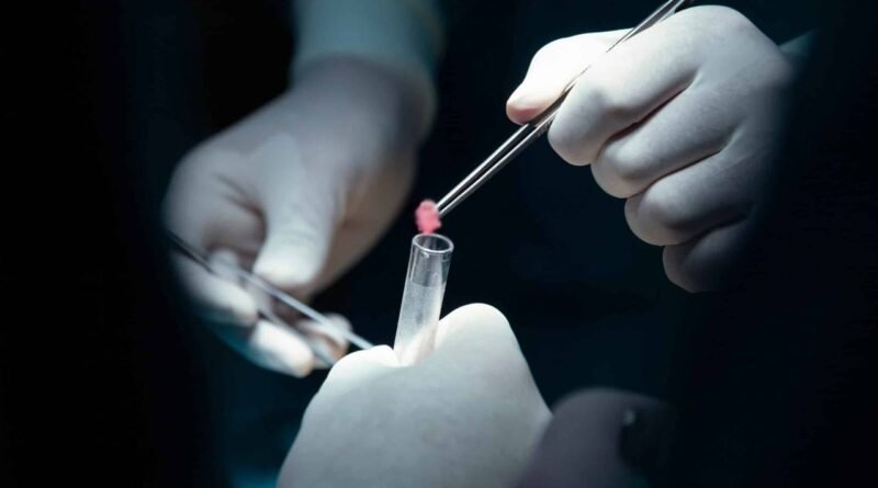 Biyopsi Nasıl Uygulanır?