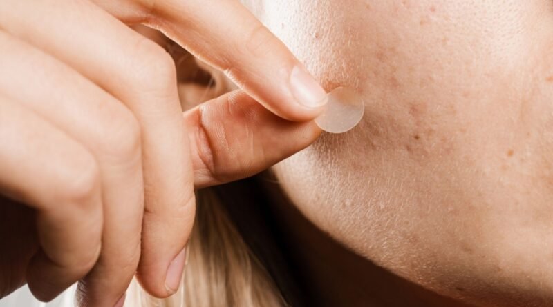 Sivilce bantları gerçekten etkili mi?