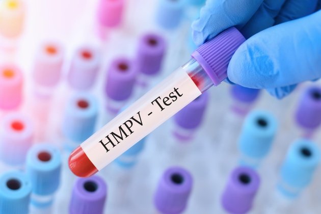 HMPV (İnsan Metapnömovirüsü) Nedir? Belirtileri ve Tedavi Yöntemleri