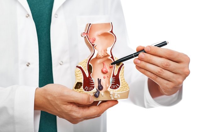 Makat (Anal) Kanseri Nedir? Belirtileri ve Tedavi Yöntemleri nelerdir?