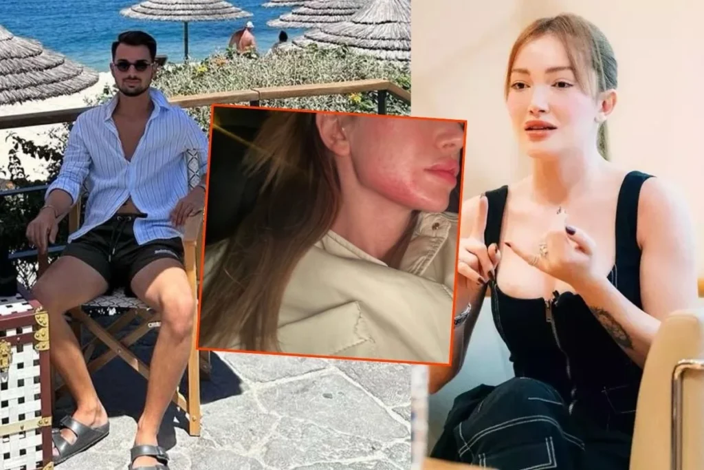 Korku Dolu Günler: "Fiziksel ve Psikolojik Şiddet Gördüm"