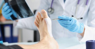 Diyabetik Ayak Nedir? Belirtileri ve Tedavi Yöntemleri