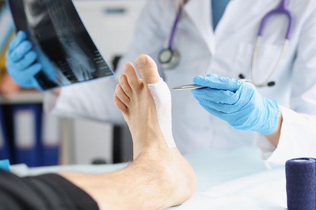 Diyabetik Ayak Nedir? Belirtileri ve Tedavi Yöntemleri