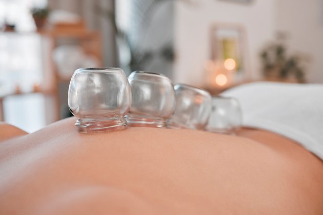 Hacamat Nedir? Faydaları ve Uygulama Yöntemleri Nasıldır?