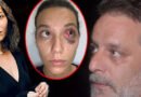 Ozan Güven İle Darp Davasında Karar Açıklandı!