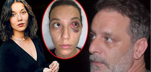 Ozan Güven İle Darp Davasında Karar Açıklandı!