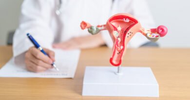 Endometriozis Nedir ve Belirtileri Nelerdir?