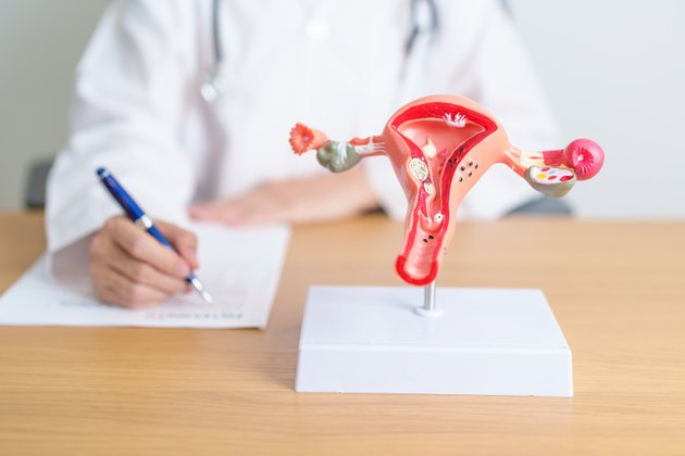 Endometriozis Nedir ve Belirtileri Nelerdir?