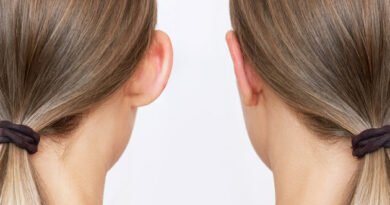 Kepçe Kulak Ameliyatı (Otoplasti) Nedir? Belirtileri ve Tedavi Yöntemleri