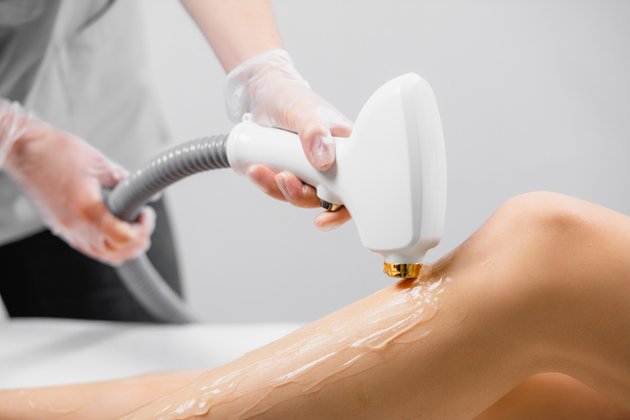 Lazer Epilasyon: Nedir ve Zararlı mı?