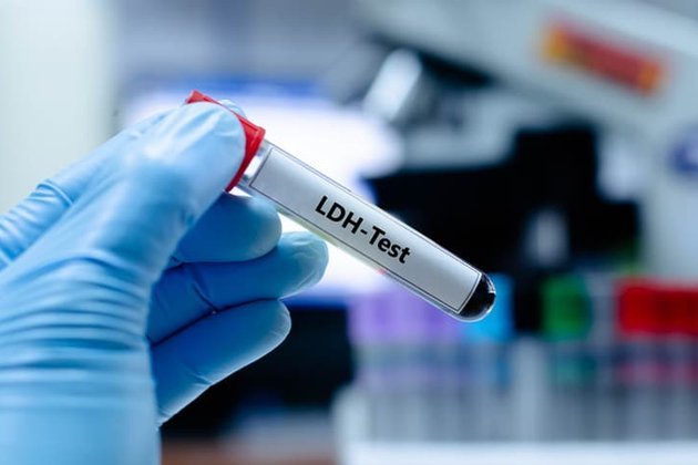 LDH Nedir? LDH Yüksek ve Düşük Seviyeleri Ne Anlama Geliyor?