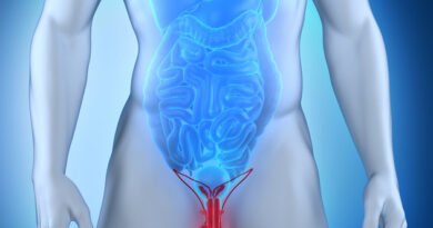 Testis Kanseri: Belirtiler, Tanı Süreci ve Tedavi Yöntemleri