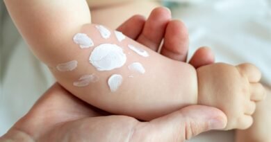 Bebekler ve çocuklarda güneş yanığına nasıl çözüm bulunur? | Anne