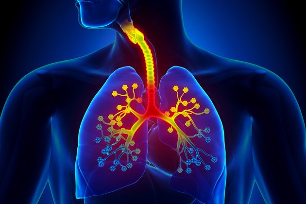 Bronşit Nedir ve Belirtileri Nelerdir?