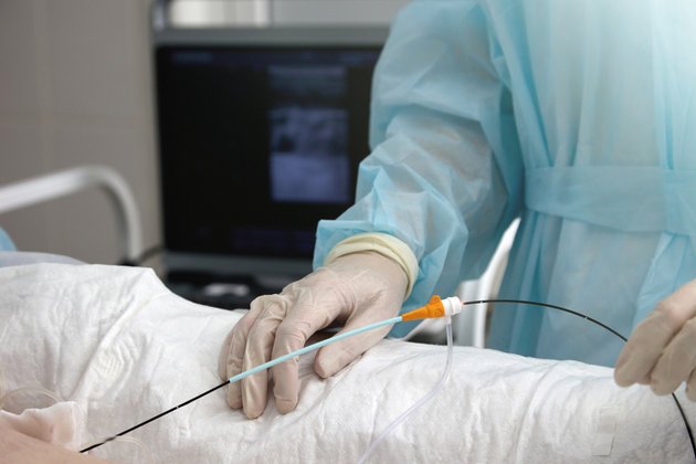 Ablasyon Nedir? Ablasyon Tedavisi Hakkında | Anadolu Sağlık Merkezi Hastanesi