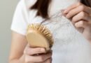Saç kaybının sebepleri nelerdir? | Estetik