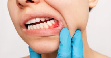 Aft Nedir ve Nasıl Geçer?