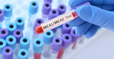 BRCA1 ve BRCA2 Genetik Analizleri