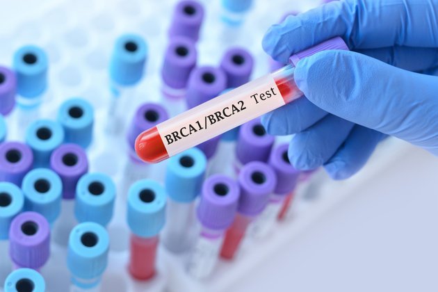 BRCA1 ve BRCA2 Genetik Analizleri
