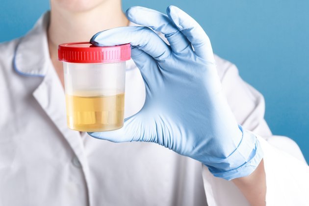 İdrarda Protein Kaçağı: Nedir? Belirtileri ve Tedavi Yöntemleri