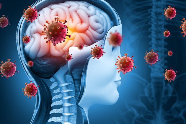 Menenjit Nedir ve Nasıl Bulaşır?