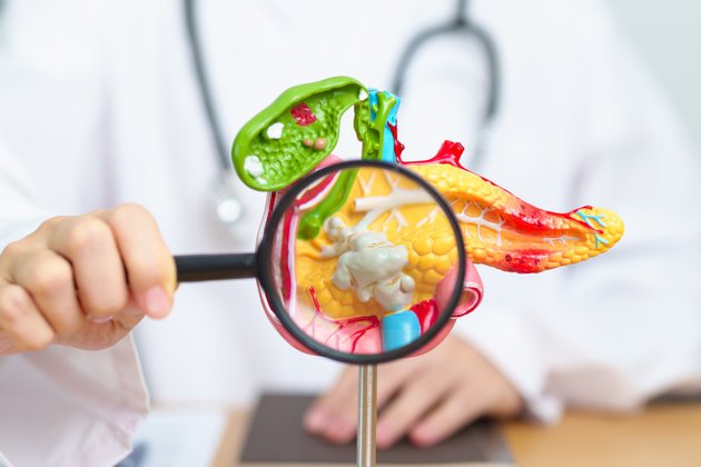 Pankreatit: Nedir, Belirtileri ve Tedavi Yöntemleri Nelerdir?