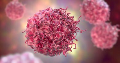 Yumuşak Doku Kanseri (Sarkom): Nedir, Belirtileri ve Tedavi Yöntemleri