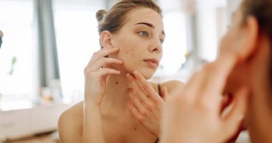 İzotretinoin Nedir ve Ne Amaçla Kullanılır?