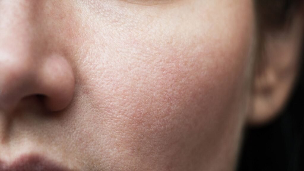 Ciltte yaşlanmaya neden olan etkenler nelerdir? | Estetik