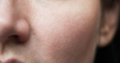 Ciltte yaşlanmaya neden olan etkenler nelerdir? | Estetik