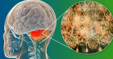 Beyincik Sarkması: Tanım, Belirtiler ve Tedavi Yöntemleri Nelerdir?