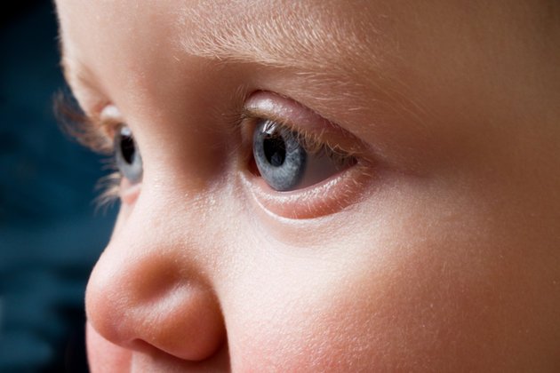 Çocuklarda Retinoblastom: Nedir, Belirtileri ve Tedavi Yöntemleri