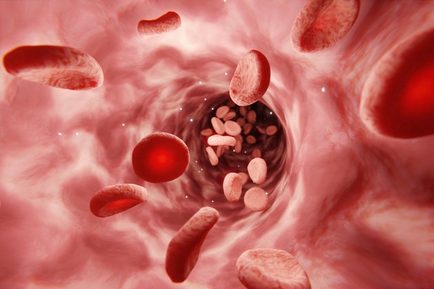 Hipovolemi Nedir? Hipovolemi Şokunun Belirtileri Nelerdir?