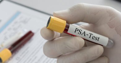 PSA Nedir? PSA Testi Değerleri Ne Olmalı?