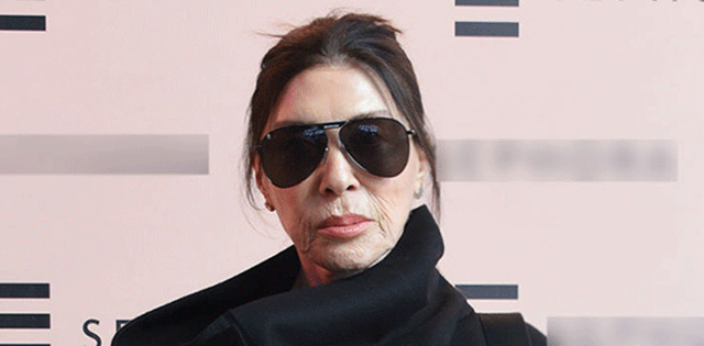 Estetik Yaptırmadığım Belli