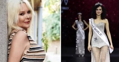 Türkiye Güzeli Seçenlere 'Çarpık Bacak' Eleştirisi!