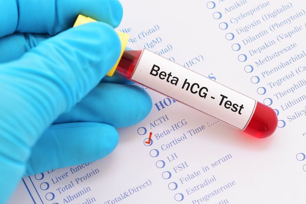 Beta HCG Nedir? Gebelikte Hafta Hafta Beta HCG Seviyeleri