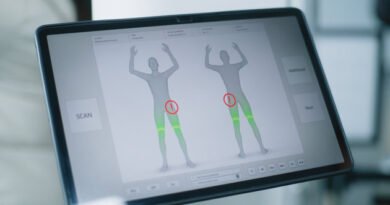 Tüm Vücut Haritalama Tekniği ile Ben Tarama Süreci