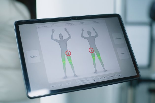 Tüm Vücut Haritalama Tekniği ile Ben Tarama Süreci