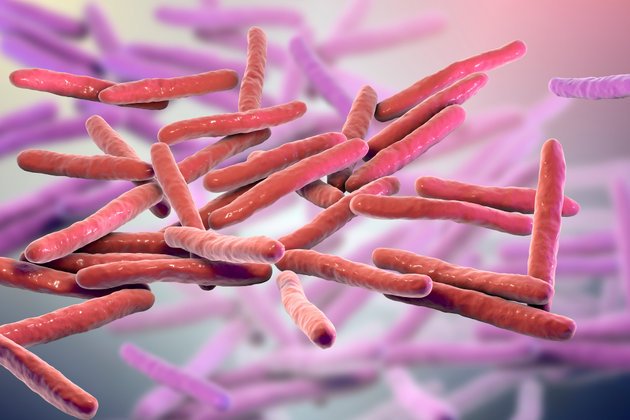 Cüzzam Hastalığı Nedir? Belirtileri Nelerdir?