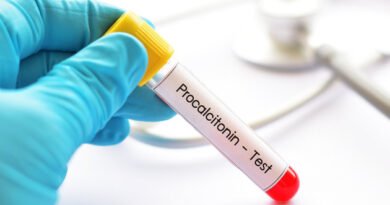 PCT Nedir? PCT Yüksekliği ve Düşüklüğü Hakkında Bilgi