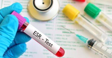Sedimantasyon Nedir? Belirtileri, Nedenleri ve Tedavi Yöntemleriyle İnceleme