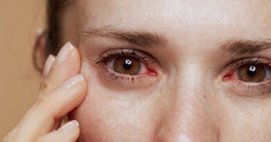 Üveit Nedir? Belirtileri Nelerdir?