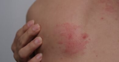 Candida Mantarı Nedir? Belirtileri, Nedenleri ve Tedavi Yöntemleri