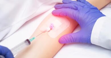 Monosit (MON) Nedir? Monosit Belirtileri, Nedenleri ve Tedavi Yöntemleri