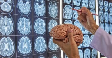 Beyin Ölümü Nedir ve Belirtileri Nelerdir?