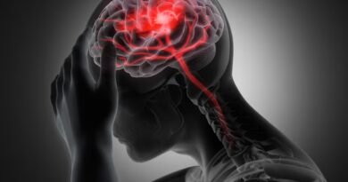 Geçici İskemik Atak (TIA): Nedir, Nedenleri, Belirtileri ve Tedavi Yöntemleri