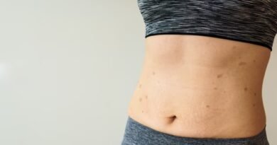 Göbek Düşmesi: Nedir, Nedenleri, Belirtileri ve Tedavi Yöntemleri