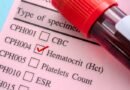 HCT (Hematokrit) Nedir? Düşüklüğü, Yüksekliği ve Tedavi Yöntemleri