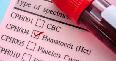 HCT (Hematokrit) Nedir? Düşüklüğü, Yüksekliği ve Tedavi Yöntemleri